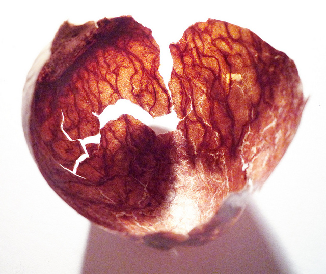 broken-heart-and-vessels.jpg